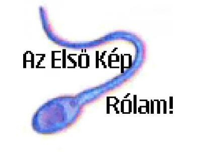 elsokepem