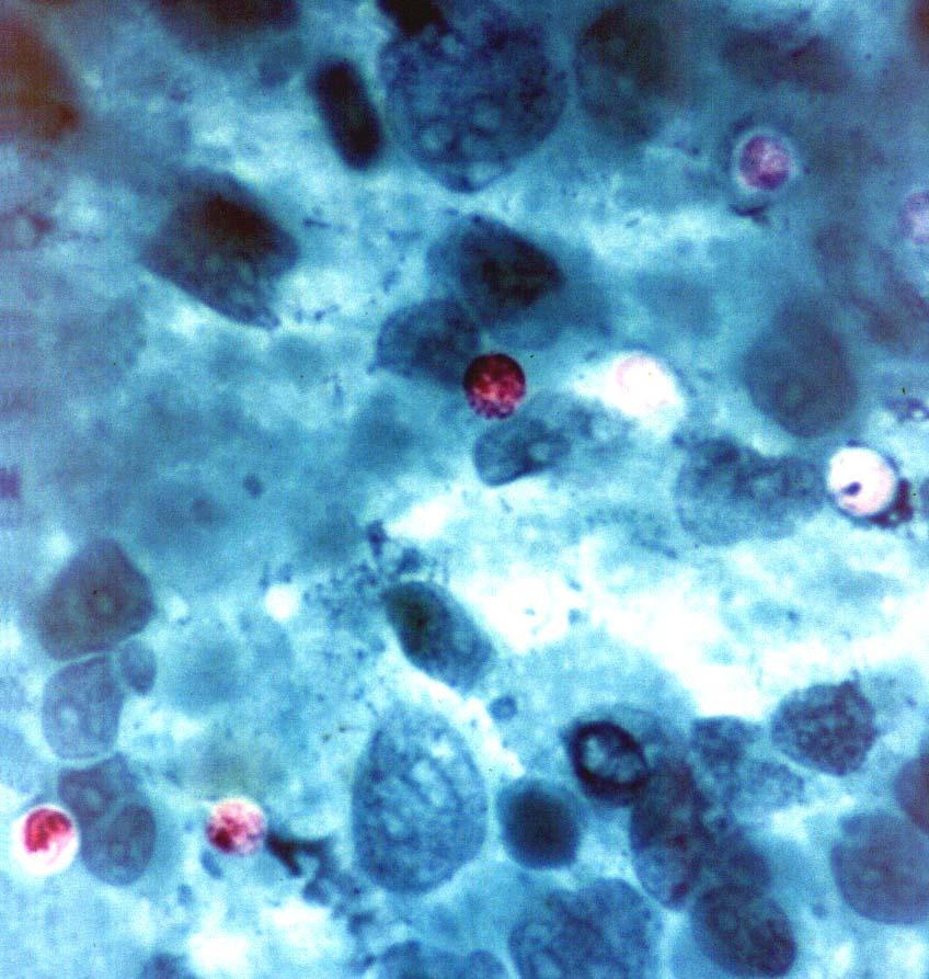 cryptosporidium varani (oocysta gekkó)