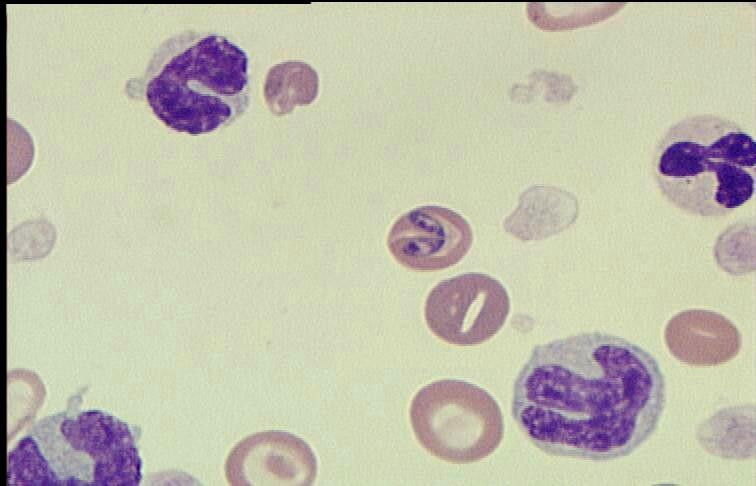 babesia canis2